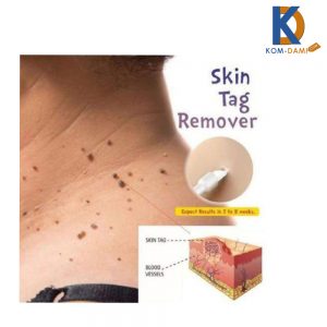 Skin Tag Remover 6ml